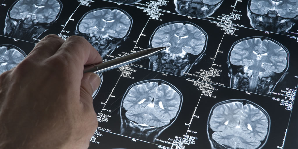 New study reveals the genes that drive cancer in a subset of patients