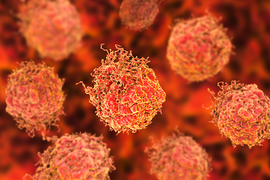 F0202638-Prostate_cancer_cells,_illustration-SPL F0202638-Prostate_cancer_cells,_illustration-SPL